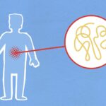 Gastroshiza: Your Expert Guide